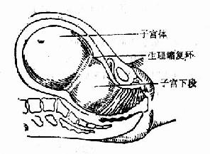 子宫颈的变化 (1)子宫颈管消失 临产前的子宫颈管长约2cm,初产妇较经