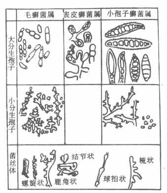 >> 微生物学    图20-1 皮肤丝状菌的孢子及菌丝形态 有些真菌在不同