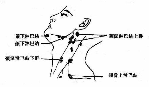 如耳,乳突区的淋巴结接受来自头皮的淋巴液;颌下淋巴结群接受口底,颊