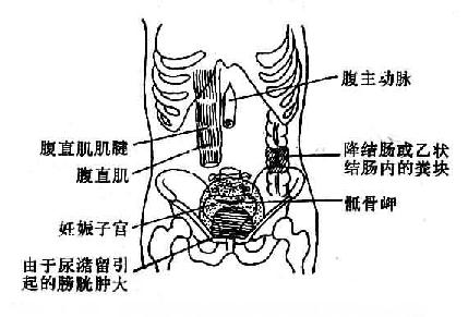腹主动脉脐的深处,沿腹中线或偏左可触及腹主动脉的搏动. 2.