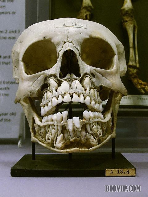 处于换牙期的儿童头骨，能同时看到乳牙和等待萌出的恒牙