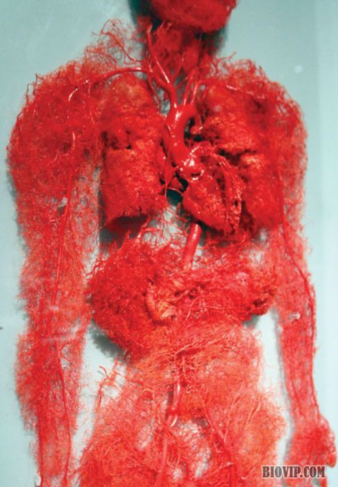人体血管铸型